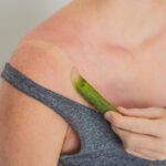 remedii-arsuri-piele